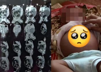 Baju Terdedah Dirakam Tanpa Izin, Ibu Hamil Naik Angin Di Tren Sampai Keguguran