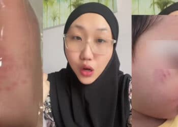 [MUAR] Bomoh ‘Ratah’ Gadis 14 Tahun Sampai Hamil Ketika Buat Rawatan Santau