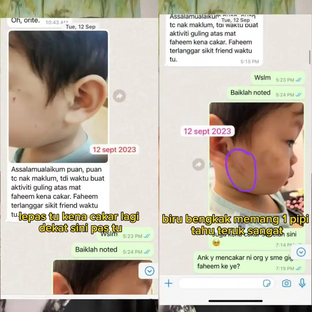 5 Bulan Digigit Dicakar Budak Lain, Ibu Terkilan Anak Diberhentikan Dari Taska