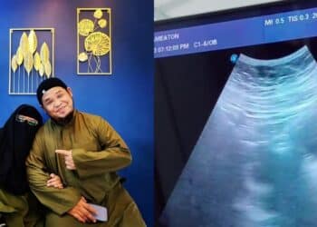 Video CCTV Detik – Detik Mencemaskan Anak Ain Edruce Terkena Sawan