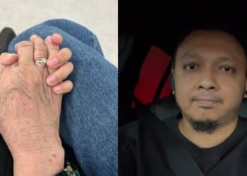 Achey Terkejut Anak Pakai Gigi Palsu Nenek “Astaghfirullah Pergi Bagi Tokmak”