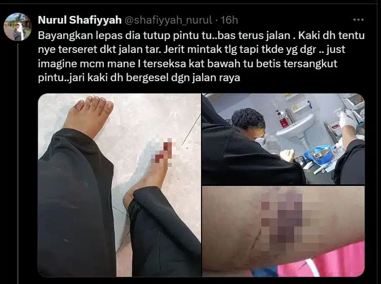 Penumpang Terperangkap Di Bonet Bas, Kaki ‘Terjulur’ Keluar & Terseret 5 Minit