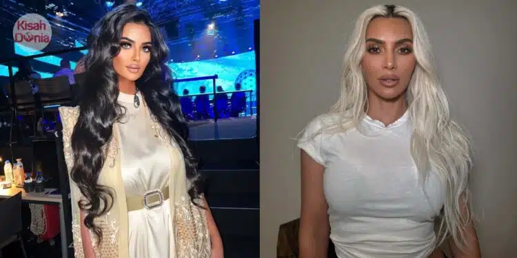 Cucuk Filler Demi Mirip Kim Kardashian, Influencer Tanggung Masalah Kesuburan