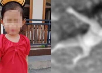 Angkara Cemburu, Rakan Perdaya Artis Inject Kolagen, Rupanya Berisi Minyak Masak
