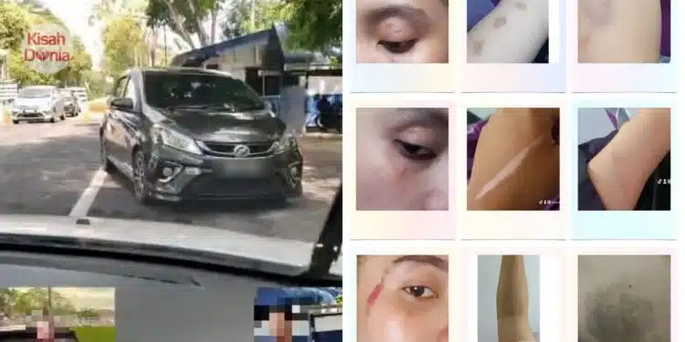 Dituduh Skandal Dengan Polis, Isteri Papar Bukti Dikasari, Suami VC Ramai Wanita