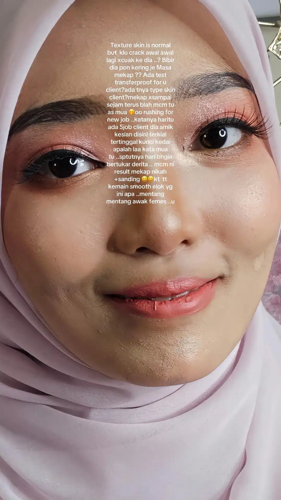 “Cantik Di Gambar Tapi Crack, Tak Cover Parut, Capuk” – Wakil Pengantin Bersuara