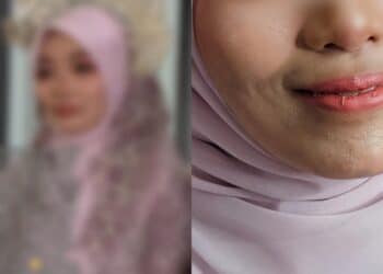 Kisah Wanita Jaga Suami Lumpuh Hingga Sembuh Sudah Tular Sampai Ke Arab Saudi