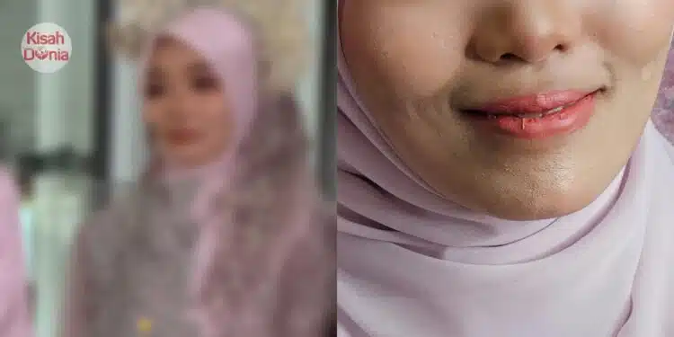 “Cantik Di Gambar Tapi Crack, Tak Cover Parut, Capuk” – Wakil Pengantin Bersuara