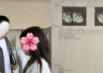 Wanita Dirasuk Ketika Dialisis “Terima Kasih Bagi, 2 Tahun Aku Tunggu Hehehehe”