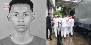 Bibir Ada Kesan Gigit, Lelaki Pergi Selamanya Selepas Otak Dijangkiti Kuman