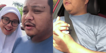 Bibir Ada Kesan Gigit, Lelaki Pergi Selamanya Selepas Otak Dijangkiti Kuman