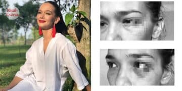 Ibu Ayah Sudah Tiada, Rakan Bantu Bawa Azzahra Ke HKL Lepas Dikasari Jay Iswazir