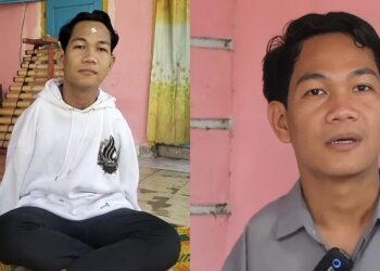 Bibir Ada Kesan Gigit, Lelaki Pergi Selamanya Selepas Otak Dijangkiti Kuman