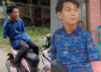 Bibir Ada Kesan Gigit, Lelaki Pergi Selamanya Selepas Otak Dijangkiti Kuman