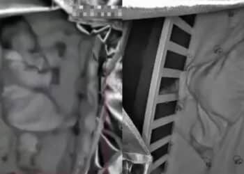 Saudara Pelik Tubuh Berubah, Gadis OKU Rupanya Hamil 6 Bulan ‘Digilir’ 9 Lelaki