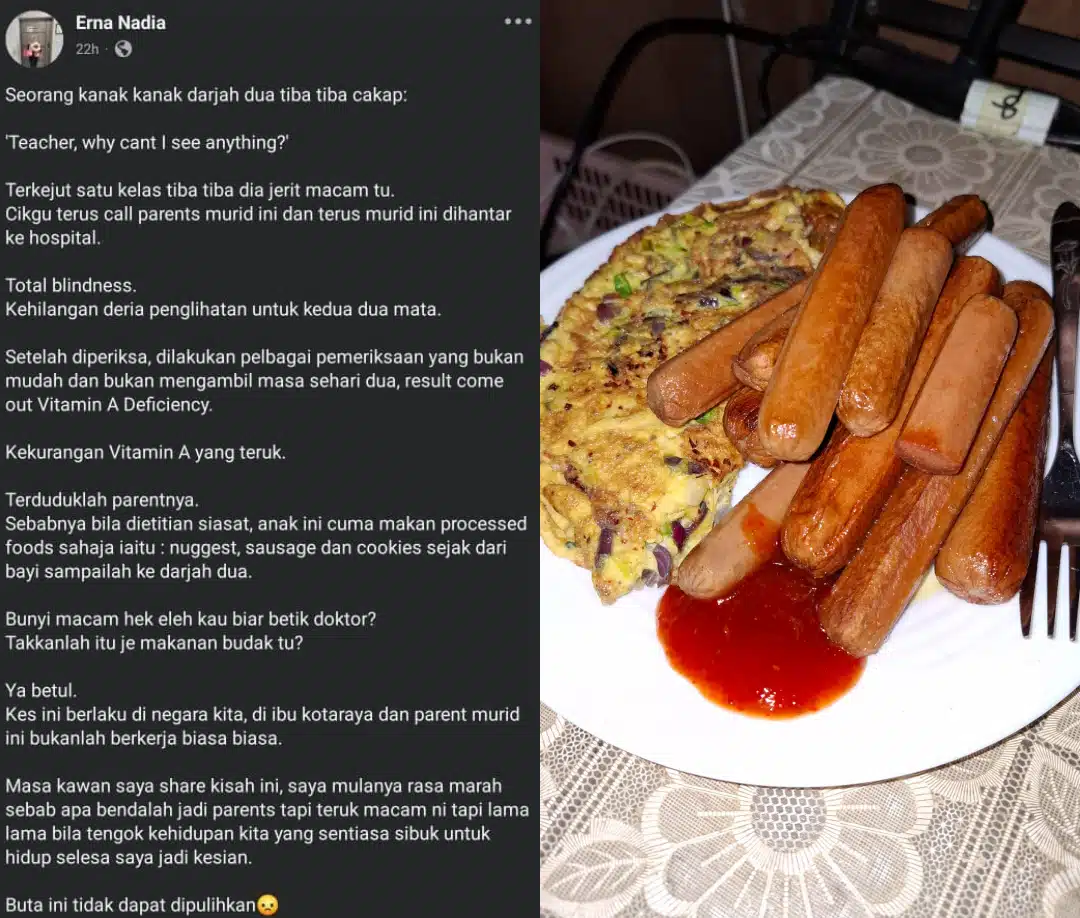 Murid Darjah 2 Tiba-Tiba Buta Di Kelas, Rupanya Sebab Tabiat Makan Sosej & Nuget