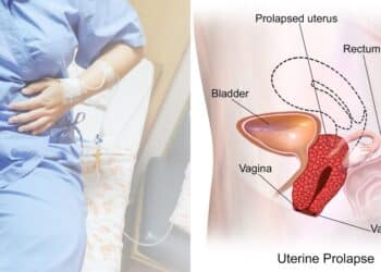 Suami Hilang Di Hutan, Isteri Risau Mencari, Rupanya Syok Bercuti Dengan Skandal