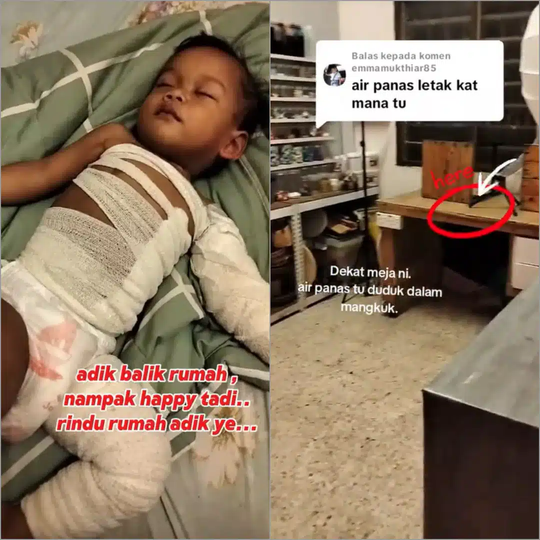 Peniaga Kek Rasa Bersalah, Anak Tercapai Mangkuk Air Panas Ketika LIVE TikTok