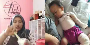 Peniaga Kek Rasa Bersalah, Anak Tercapai Mangkuk Air Panas Ketika LIVE TikTok