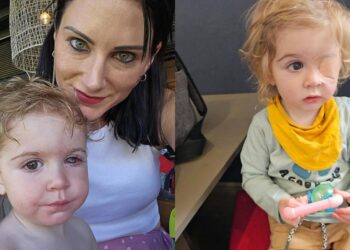 Dikucup Seseorang, Mata Anak Ditumbuhi Lubang Sebesar 4MM & Kini Disahkan Buta