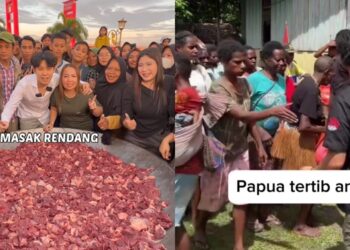 Dikucup Seseorang, Mata Anak Ditumbuhi Lubang Sebesar 4MM & Kini Disahkan Buta