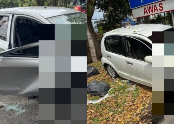 Dikucup Seseorang, Mata Anak Ditumbuhi Lubang Sebesar 4MM & Kini Disahkan Buta