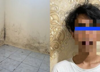 Dikucup Seseorang, Mata Anak Ditumbuhi Lubang Sebesar 4MM & Kini Disahkan Buta