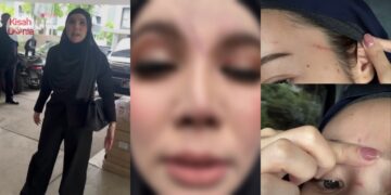 “Aku Nampak Kau Berkepit Dengan Ex-Wife, Kau Tengok” Jo Cuba Kasari Pembantu CE