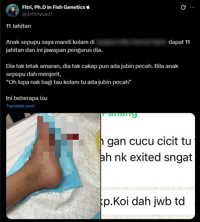 Budak Terima 11 Jahitan, Pihak Villa Tak Beritahu Ada Jubin Pecah Di Kolam Mandi