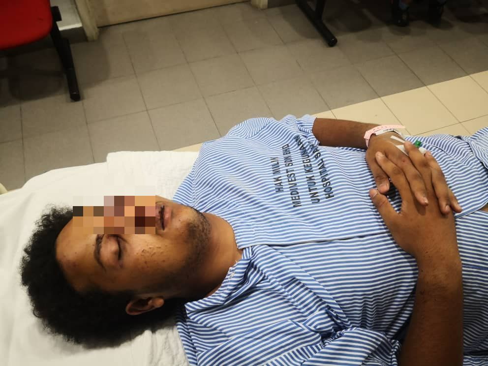 Pemuda Dikeroyok Geng Samseng Hingga Senget Tulang Rahang, Rupanya Silap Orang