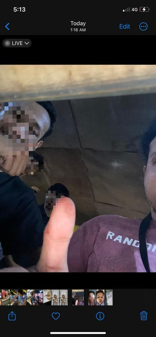Pemuda Dikeroyok Geng Samseng Hingga Senget Tulang Rahang, Rupanya Silap Orang