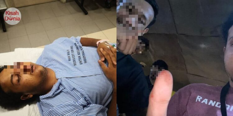 Pemuda Dikeroyok Geng Samseng Hingga Senget Tulang Rahang, Rupanya Silap Orang