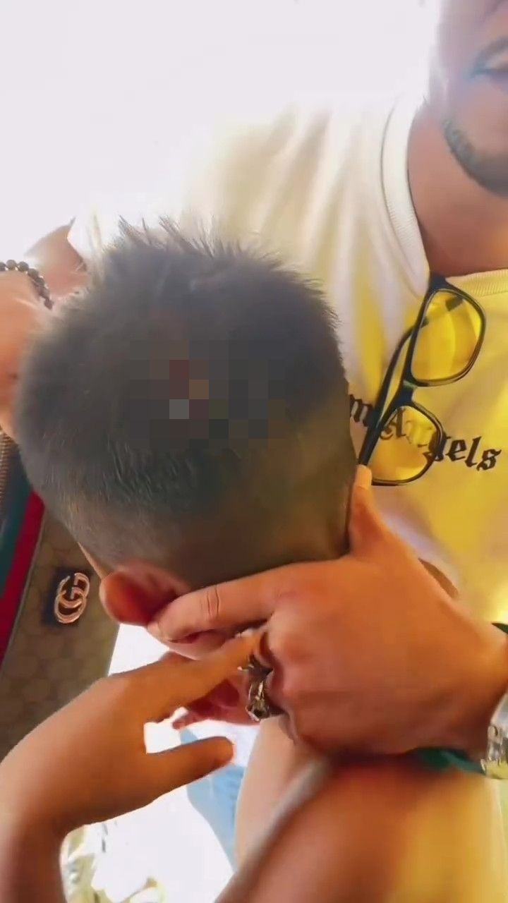 “Sampai Pecoh Pale, Melebih” Ibu Bapa Kesal Guru Baling Kotak Pensil Pada Anak