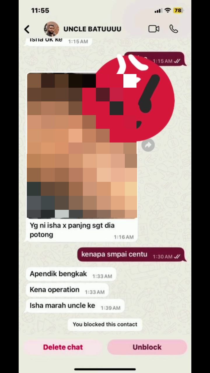 “Nak Tengok Parut Uncle? – “CEO Batu Hantar Foto Jelik Pada Pelajar Tingkatan 2