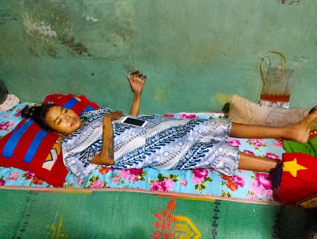Lumpuh Sepenuhnya Setelah Czer Anak Ke-4, Wanita Pilu Ditinggalkan Suami