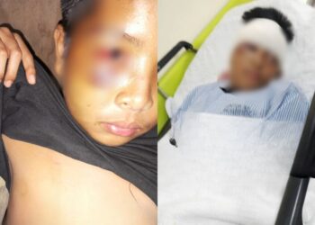 Bapa Lapor Kehilangan Anak Sejak Khamis Lalu, Rupanya Ditanam Di Kawasan Belukar