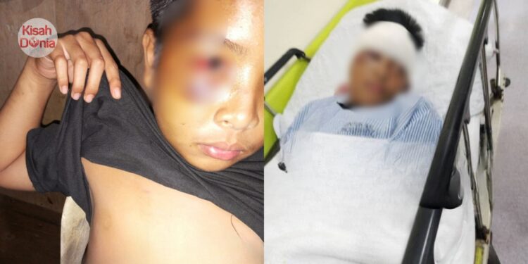 Lelaki Dedahkan Anak Pernah Dianiaya Di SMKA Sama, Namun Tiada Duit Upah Peguam