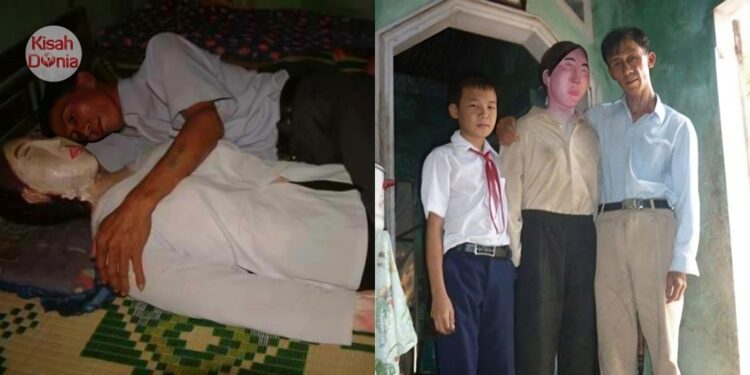Sedih Dengan Pemergian Isteri, Suami Gali Kubur & Bawa Balik Semua Sisa Tulang