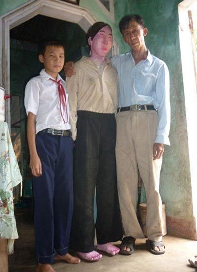 Sedih Dengan Pemergian Isteri, Suami Gali Kubur & Bawa Balik Semua Sisa Tulang
