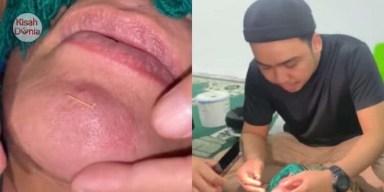 Artis Lelaki Buang Susuk, Puluhan Tahun Pakai Untuk Job ‘Lebat’ & Populariti