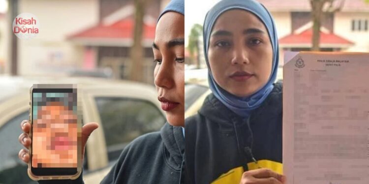 Retak Tulang Mata & Hidung, Budak Darjah 2 Di Terengganu Dianiaya Rakan Sekolah
