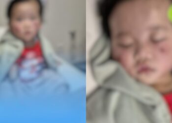“Hitam? Kenapa Ada Stretch Marks?” Isteri Terkilan Suami Menolak Malam Pertama