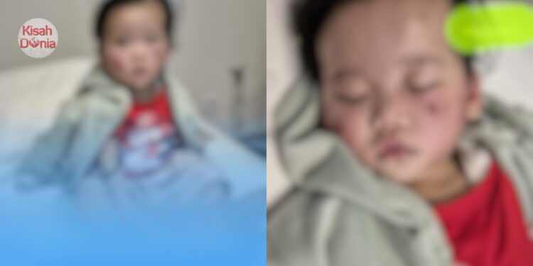 Anak Digigit Budak Lain Di Taska, Polis Suruh Ibu Cari Sendiri Rakaman Kejadian