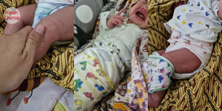 Berpantang Rumah Mentua, Bayi Dibedung Ketat & Berlapis Hingga Kulit Berbekas