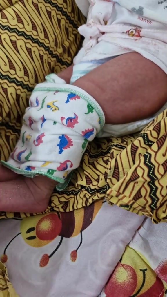 Berpantang Rumah Mentua, Bayi Dibedung Ketat & Berlapis Hingga Kulit Berbekas