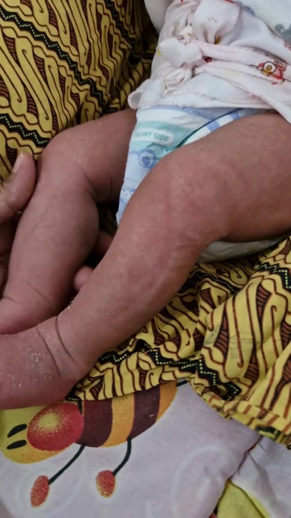 Berpantang Rumah Mentua, Bayi Dibedung Ketat & Berlapis Hingga Kulit Berbekas