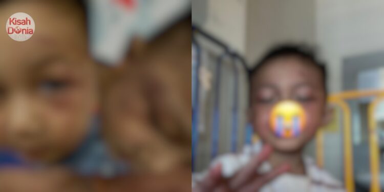 Ean Zafran Dianiaya Suami Pengasuh, Saudara Terdekat Dedahkan Kejadian Sebenar