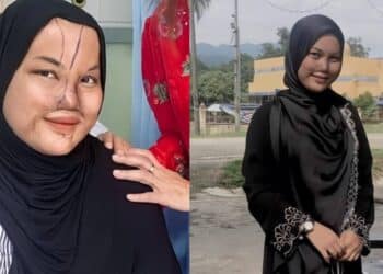 Nahas Remaja 16 Tahun : Anak Adalah Pencari Nafkah Keluarga Sejak 3 Tahun Lalu