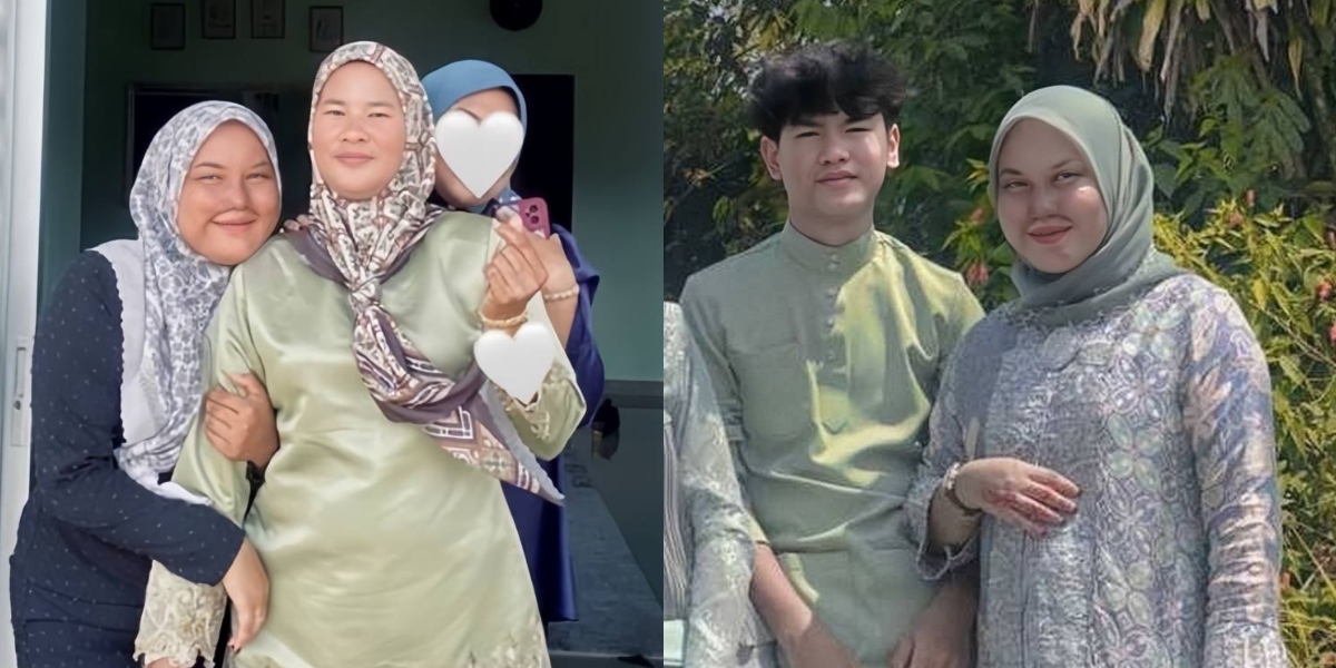 Terkena Percikan Cuka Getah, Anak Maafkan Ayah