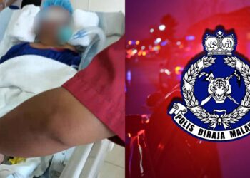 Nahas Remaja 16 Tahun : Anak Adalah Pencari Nafkah Keluarga Sejak 3 Tahun Lalu